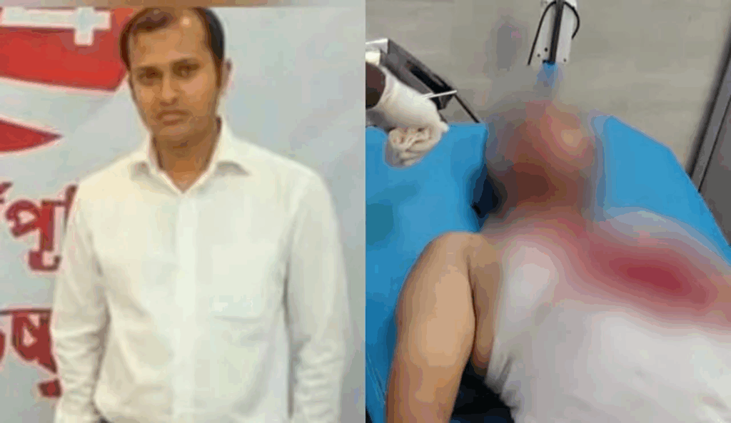 আওয়ামী লীগের মিছিল থেকে এসআইকে কুপিয়ে জখম