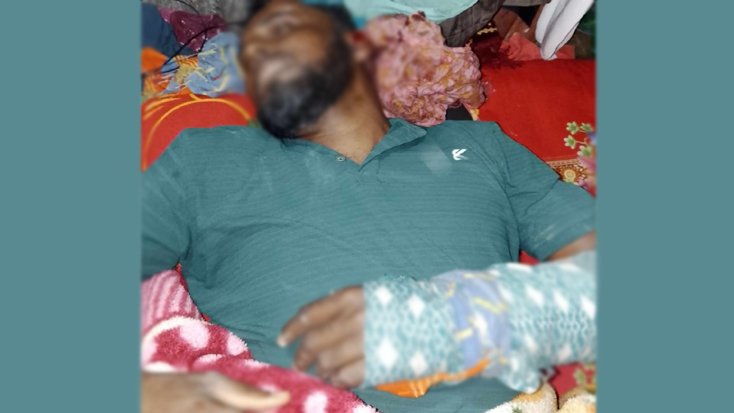 আমতলীতে পারিবারিক বিরোধে কুপিয়ে জখম-৪