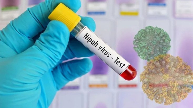 দেশে নিপাহ ভাইরাসে এক নারীর মৃত্যু সতর্কবার্তা বিশ্ব স্বাস্থ্য সংস্থার
