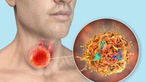 কণ্ঠস্বর ভেঙে যাওয়া বা গলা ব্যথা কখন তা ক্যান্সারের সংকেত