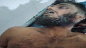 দিঘলিয়ায় ডাকাতির সময় নিজেদের গুলিতে ডাকাত নিহত