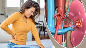 আপনার কিডনি নীরবে নষ্ট হয়ে যাচ্ছে না তো