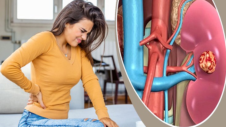 আপনার কিডনি নীরবে নষ্ট হয়ে যাচ্ছে না তো