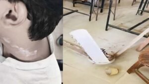 পরীক্ষার হলে ফ্যান খুলে মাথায় পড়ল শিক্ষার্থীর