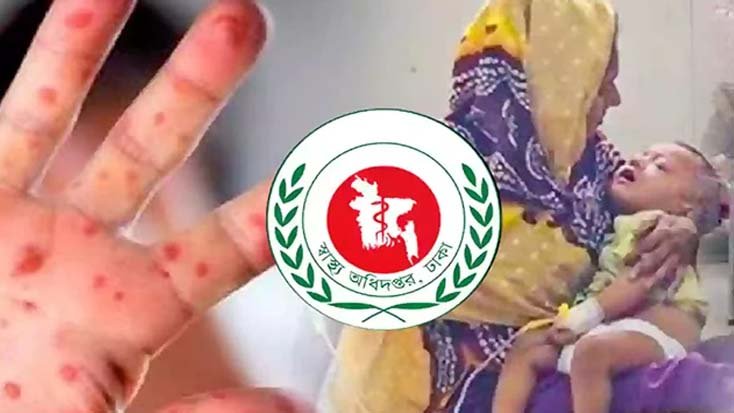 হামের উপসর্গে আরও ৯ শিশুর মৃত্যু