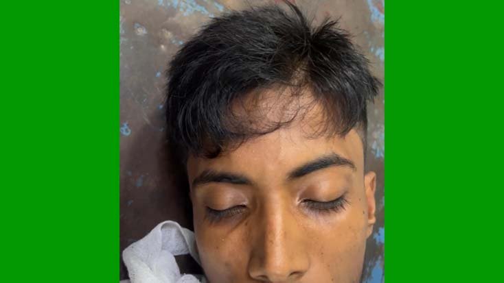 খুলনায় এনা পরিবহনের স্টাফকে গলা কেটে জখম